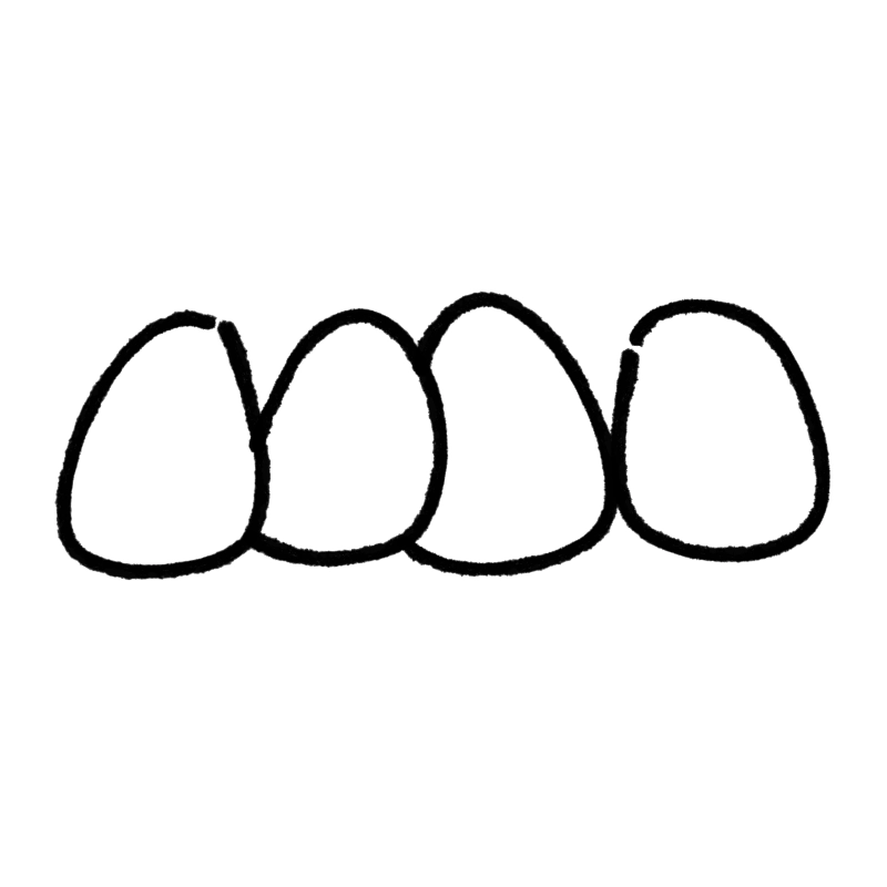 kaempf-ebert-fehlstellung-eng Icon Illustration - Fehlstellung eng