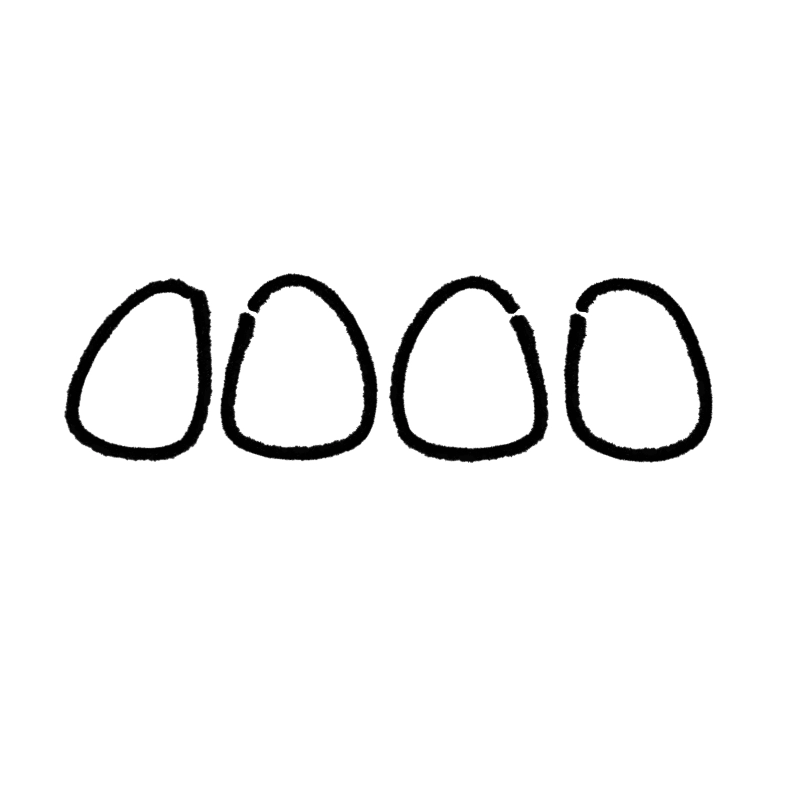 kaempf-ebert-fehlstellung-weit Icon Illustration - Fehlstellung