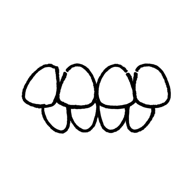 kaempf-ebert-fehlstellung-ueberbiss Illustration Überbiss
